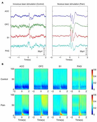 Extracting Neural Oscillation Signatures of Laser-Induced Nociception in Pain-Related Regions in Rats